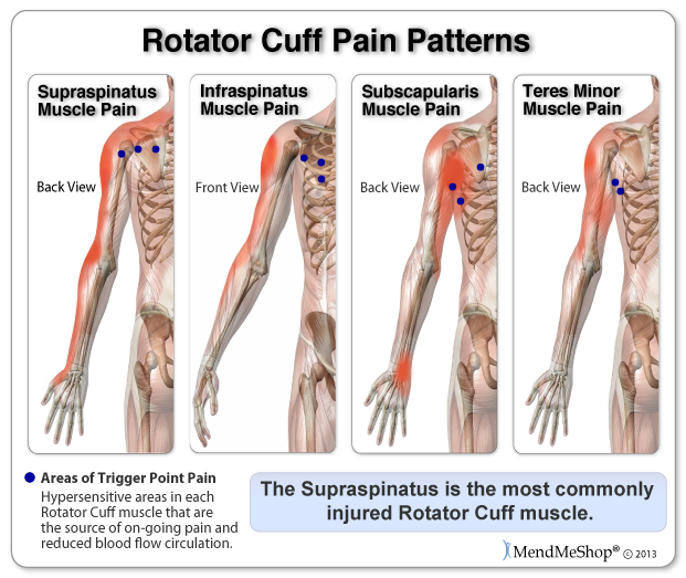 right arm rotator cuff pain